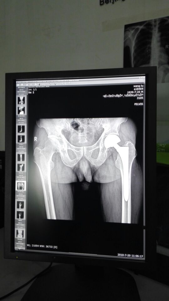 醫(yī)用顯示器