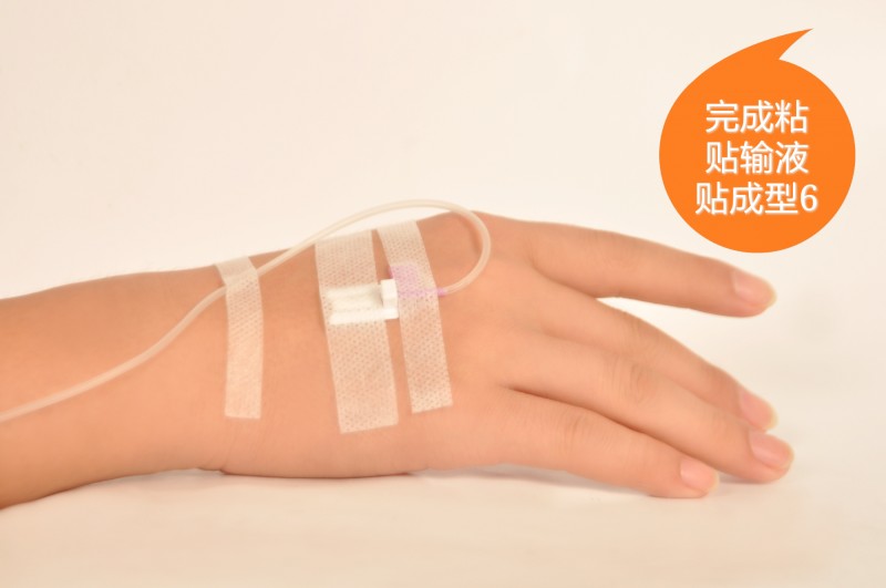 一次性使用輸液針頭固定