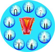 婦科設(shè)備檢查