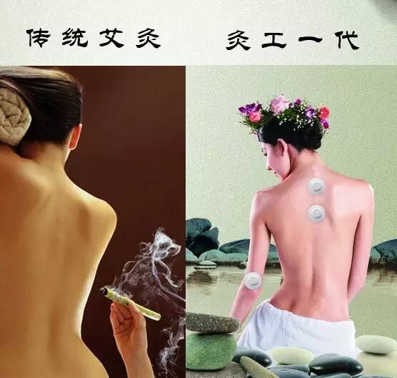 灸工一代砭合磁穴位灸療儀