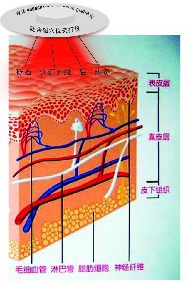 灸工一代砭合磁穴位灸療儀