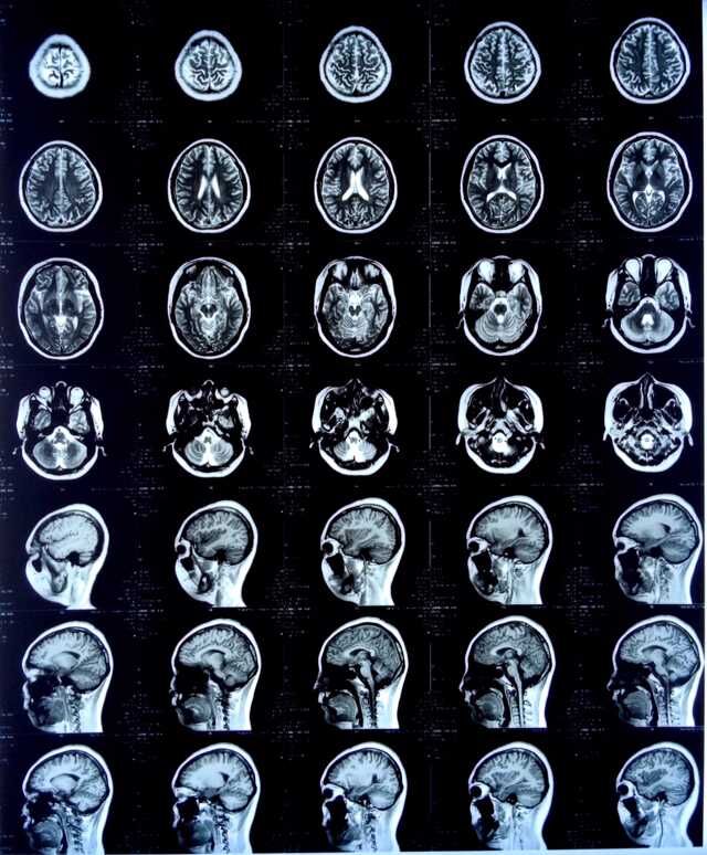 醫(yī)用膠片 熱敏膠片 廠家直銷(xiāo)