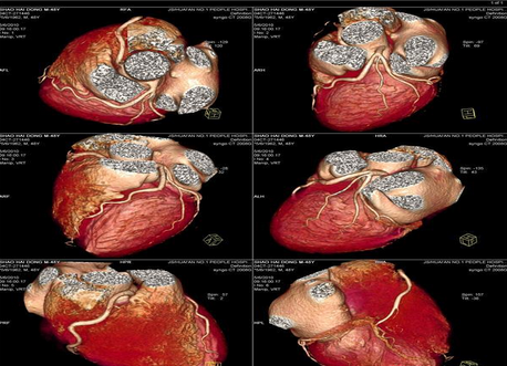 醫(yī)用干式膠片（噴墨 藍基 膠片）