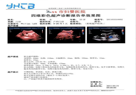 醫(yī)用干式膠片（噴墨 藍基 膠片）