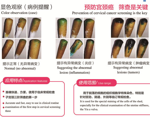 醫(yī)保產(chǎn)品： 宮檢1號 （宮頸癌快速篩查）