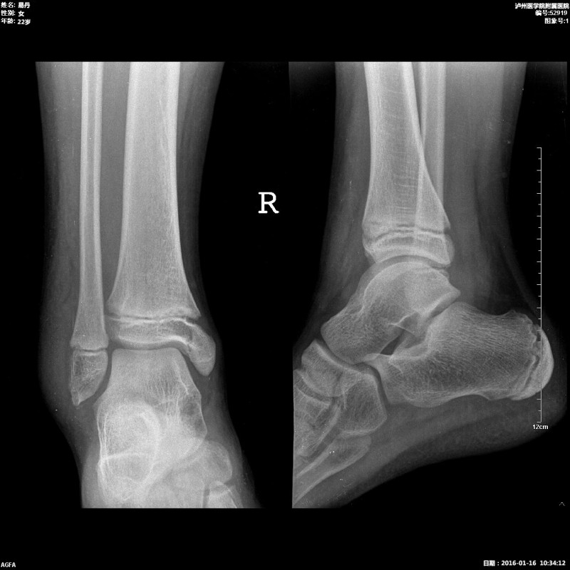 醫(yī)用膠片（B超、CT、DR）、自動取片機(jī)