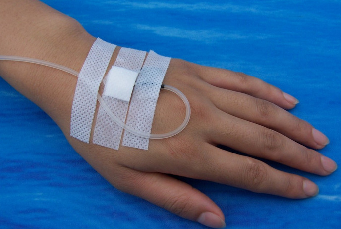 廠家供應(yīng) 醫(yī)用輸液貼/輸液膠帶/無菌敷貼/一次性耗材