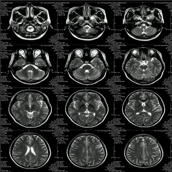 腦核磁_(tái)副本