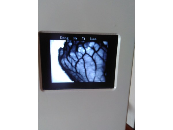 東發(fā)醫(yī)療廠家招商 靜脈顯像儀血管顯像儀 靜脈穿刺必備