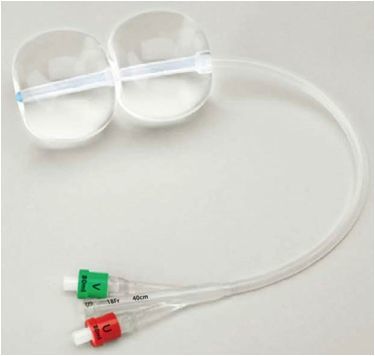 高空間利潤品種創(chuàng)健宮頸擴張球囊誠邀各地代理商合作