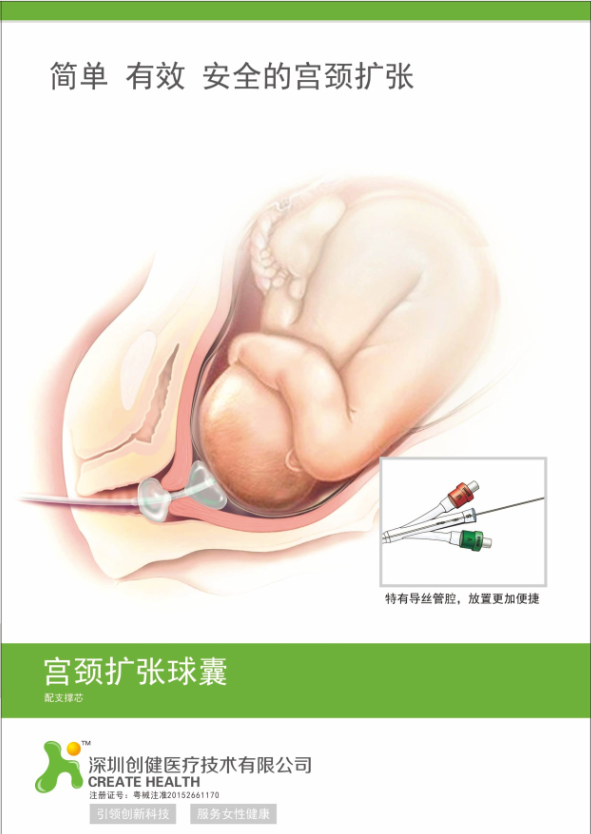 一次性使用子宮頸擴(kuò)張球囊導(dǎo)管