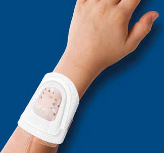 易舒寶輸液保護罩輸液貼