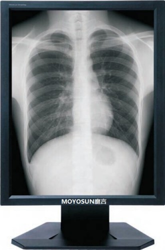 3M醫(yī)用顯示器 3M灰階顯示器 3M醫(yī)用豎屏顯示器