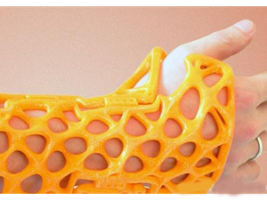 骨科新技術(shù)——3D打印手術(shù)夾板、支具