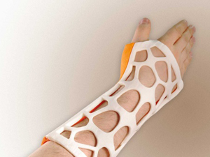 骨科新技術(shù)——3D打印手術(shù)夾板、支具