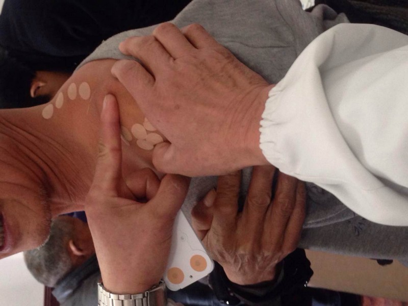 “卓脈”一次性使用無菌撳針（單/雙層固定）