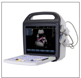 便攜式彩超C5