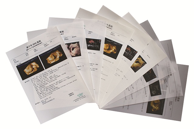 醫(yī)用打印膠片（商品名：超聲PACKS醫(yī)用診斷報(bào)告膠片）