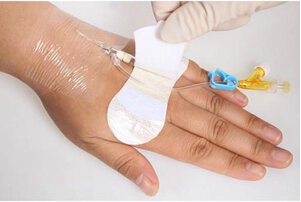 慧吉康留置針固定貼
