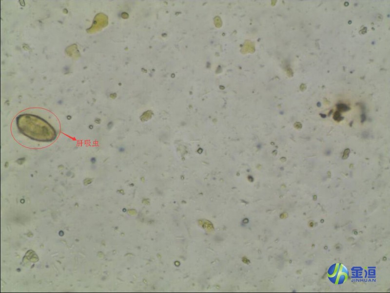 JHAFA-I 升級(jí)版 自動(dòng)糞便分析儀