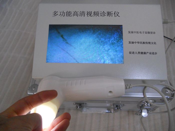 氣血檢測儀一體機(jī)