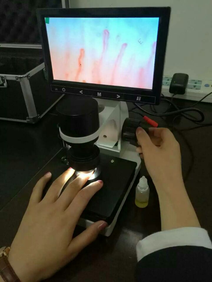 彩色微循環(huán)檢測(cè)儀