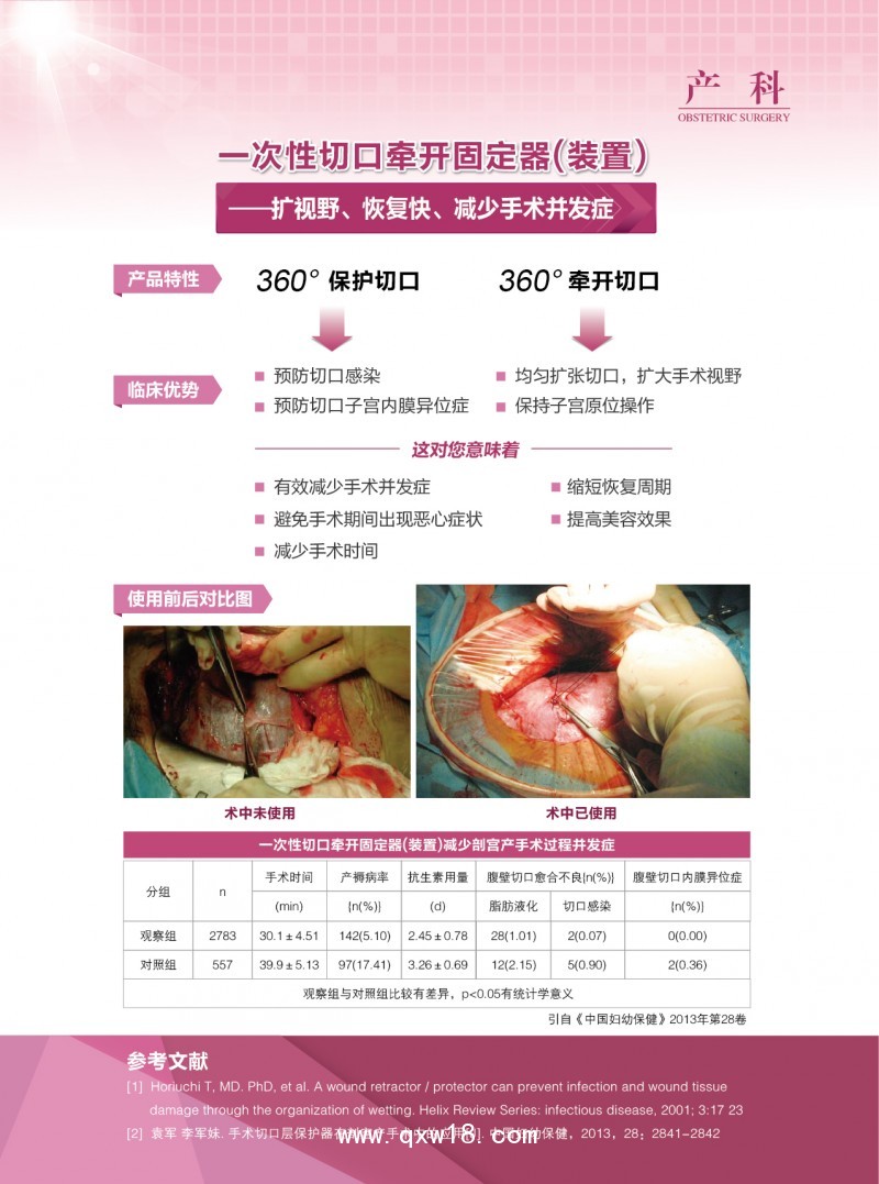 一次性切口牽開(kāi)固定器（裝置）