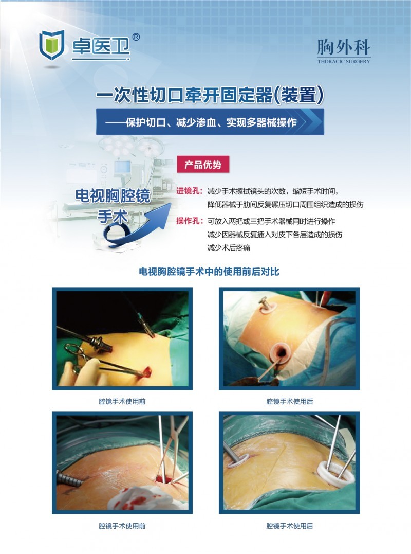 一次性切口牽開(kāi)固定器（裝置）