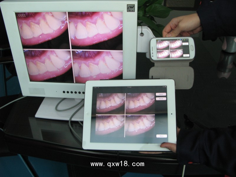 M-958AWI-FI口腔內(nèi)窺鏡一體機+15寸高清顯示器
