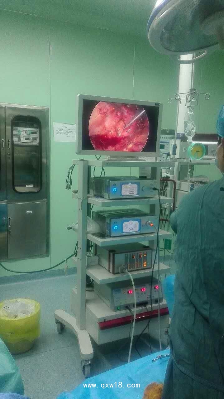 德國(guó)MGB高清腹腔鏡，高清膀胱鏡，高清輸尿管腎鏡，鼻竇鏡