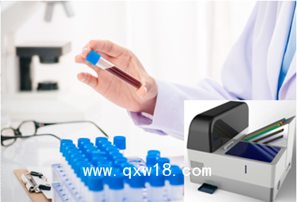 自動(dòng)貼標(biāo)系統(tǒng)