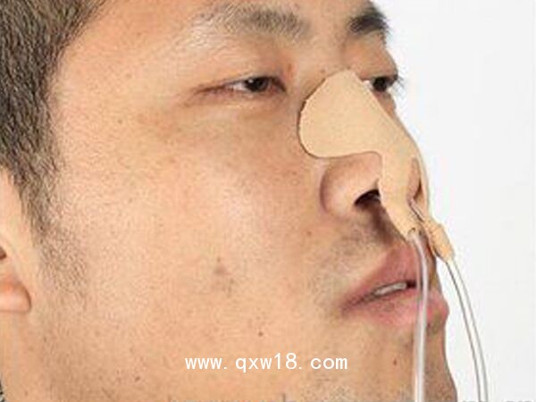 醫(yī)用導(dǎo)管夾 導(dǎo)管固定帖（鼻飼管固定貼） G型大