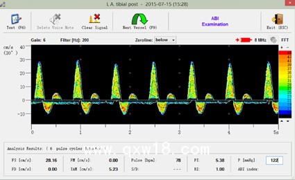 糖尿病足診斷箱