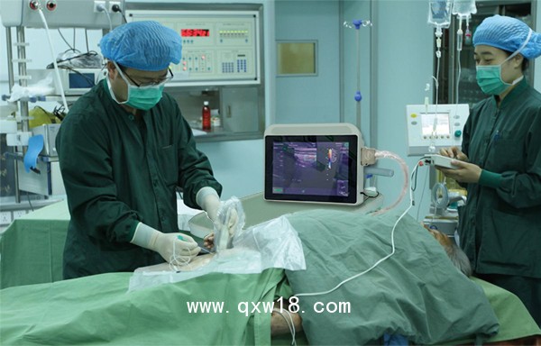 筆記本b超機(jī),便攜式彩超機(jī),便攜式b超機(jī)