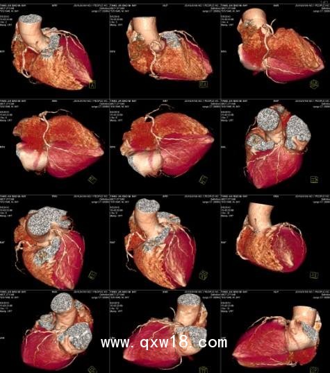 柯銳達醫(yī)用膠片自助區(qū)片機