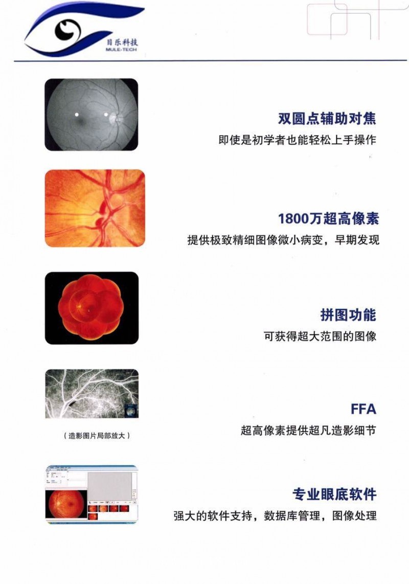 免散瞳眼底照相機