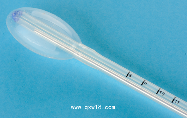 一次性球囊宮頸擴張器