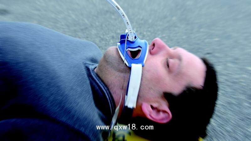 氣管插管固定器F型