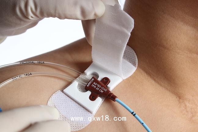 透氣膠貼（非織造布膠帶）B型（?。?>
            <div   id=