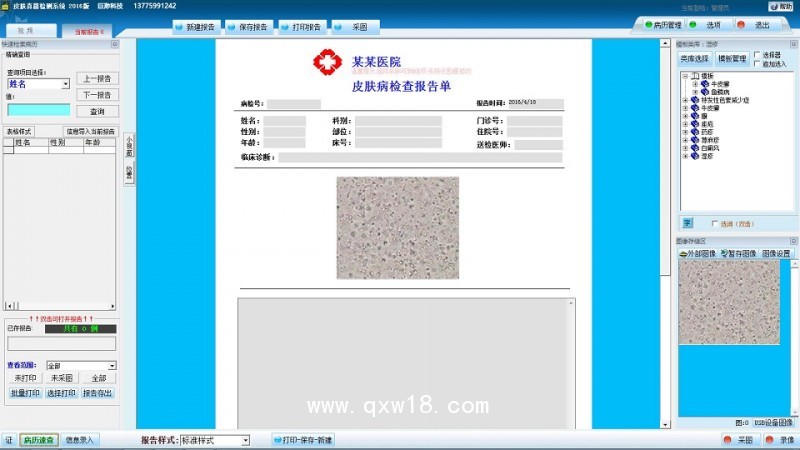 巨渺 皮膚真菌鏡檢 影像工作站 皮膚真菌圖文報(bào)告系統(tǒng)