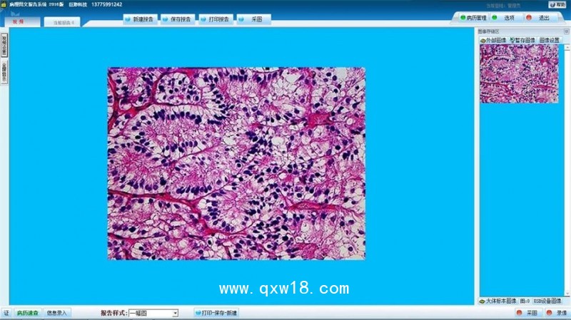 病理圖文分析系統(tǒng) 組織 細(xì)胞學(xué) 圖文報(bào)告影像工作站軟件