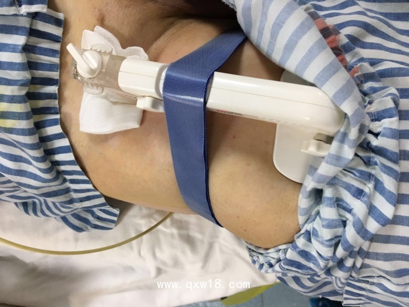 【普亞喜】動脈壓迫止血器