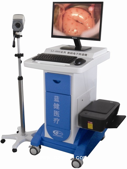 陰道鏡，高清陰道鏡，電子陰道鏡