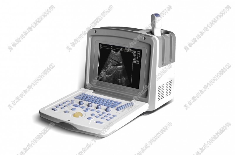 全數(shù)字超聲診斷系統(tǒng)