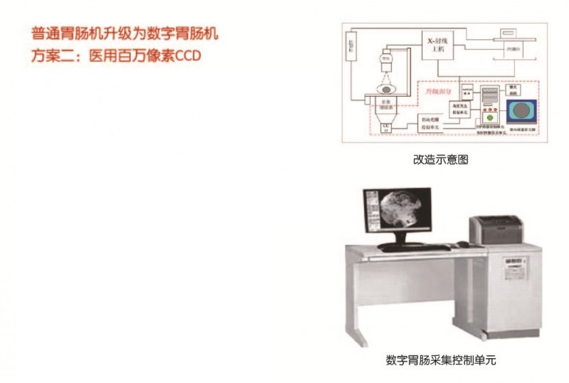 普通胃腸機升級為數(shù)字胃腸機