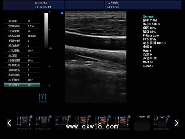 b超機 彩色b超機 心臟b超機 國產高端b超機 腹部乳腺b超