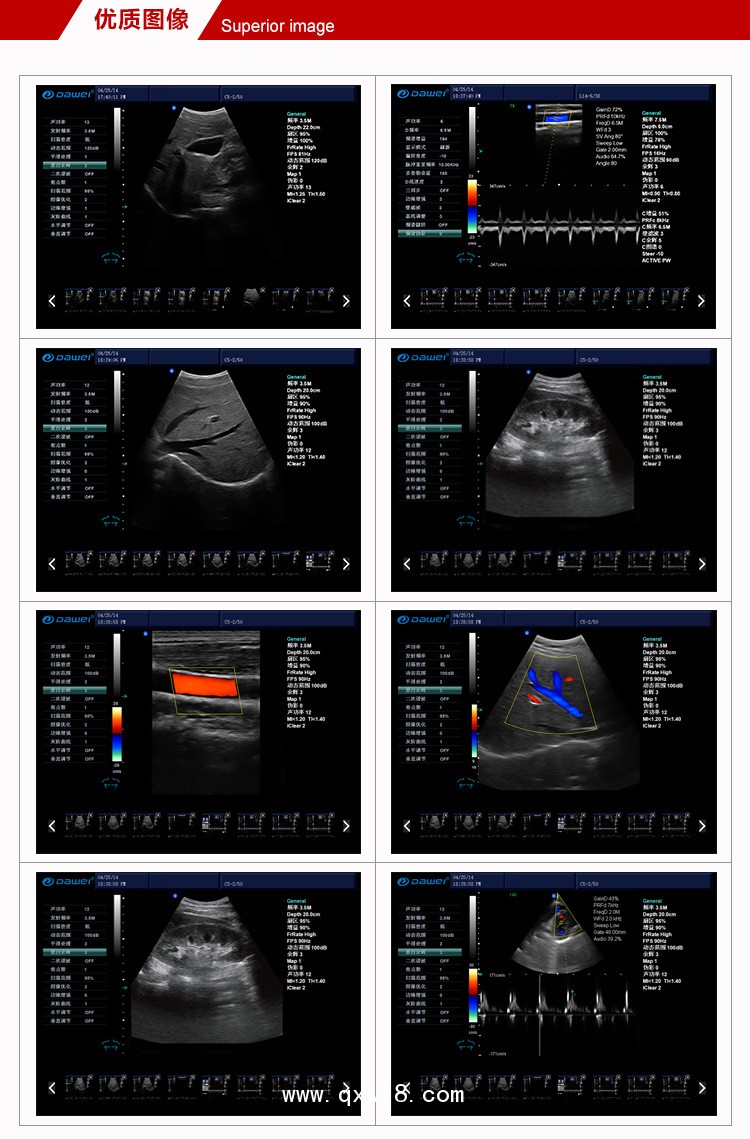 臻譽（精英版）