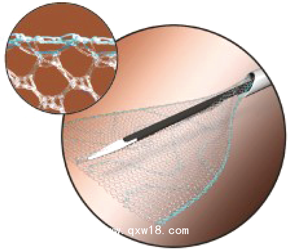 德國PVDF材質(zhì)疝氣補片-ENDOLAP