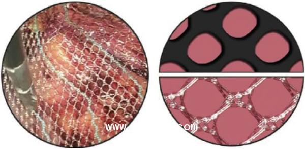 德國PVDF材質(zhì)疝氣補片-CICAT