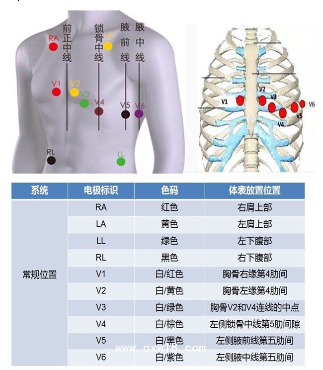 柯麗爾心臟監(jiān)護